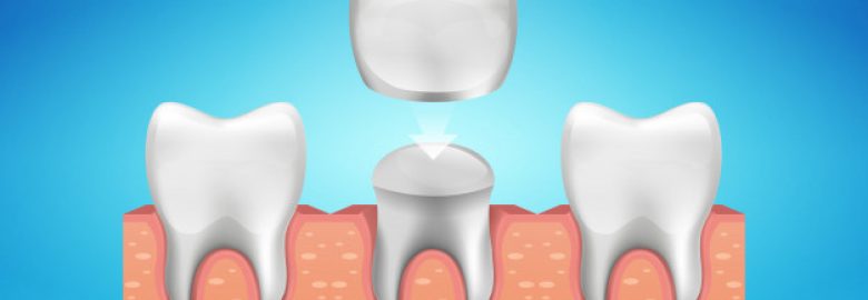 Rawson Dental Epping